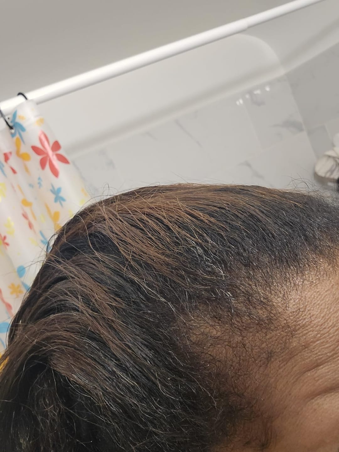 Customer photo review of NOEVA 100% Pur Batana - Le secret ancestral de cheveux sublimes