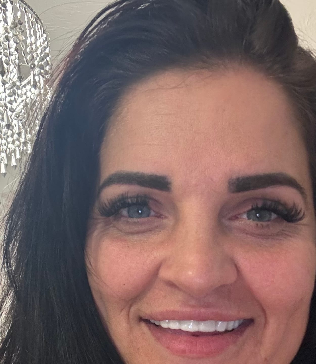 Customer photo review of Click-in Veneers 4.0