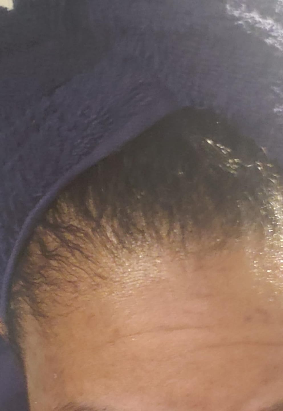 Customer photo review of NOEVA 100% Pur Batana - Le secret ancestral de cheveux sublimes