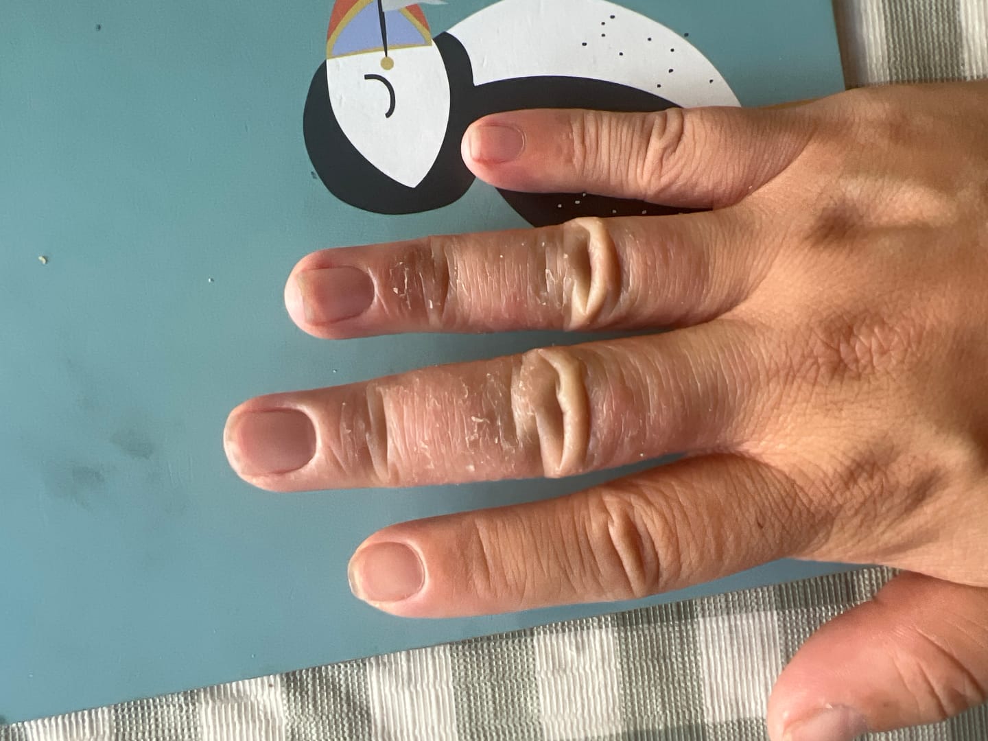 Customer photo review of Bioskin Duo Pack