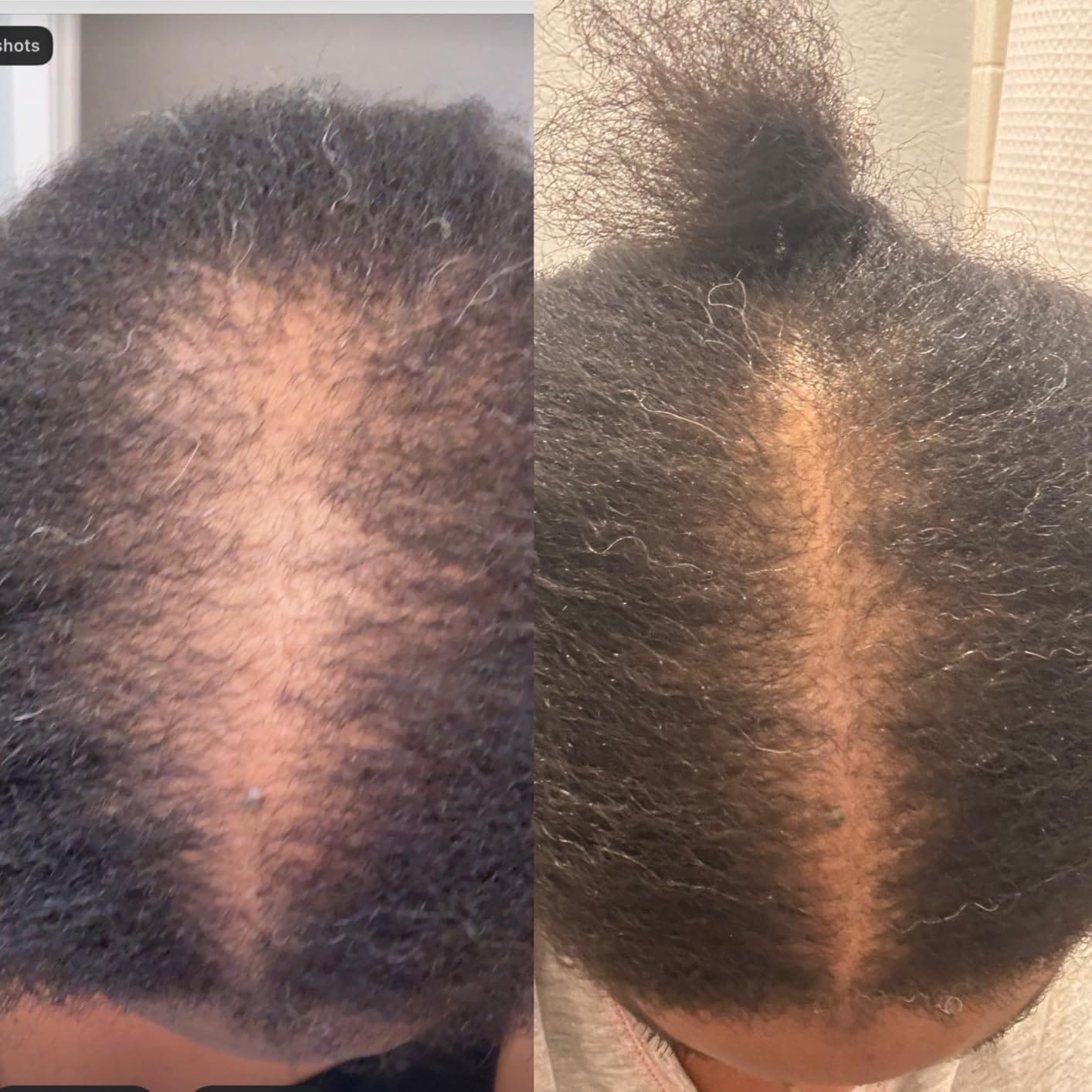 Customer photo review of NOEVA 100% Pur Batana - Le secret ancestral de cheveux sublimes