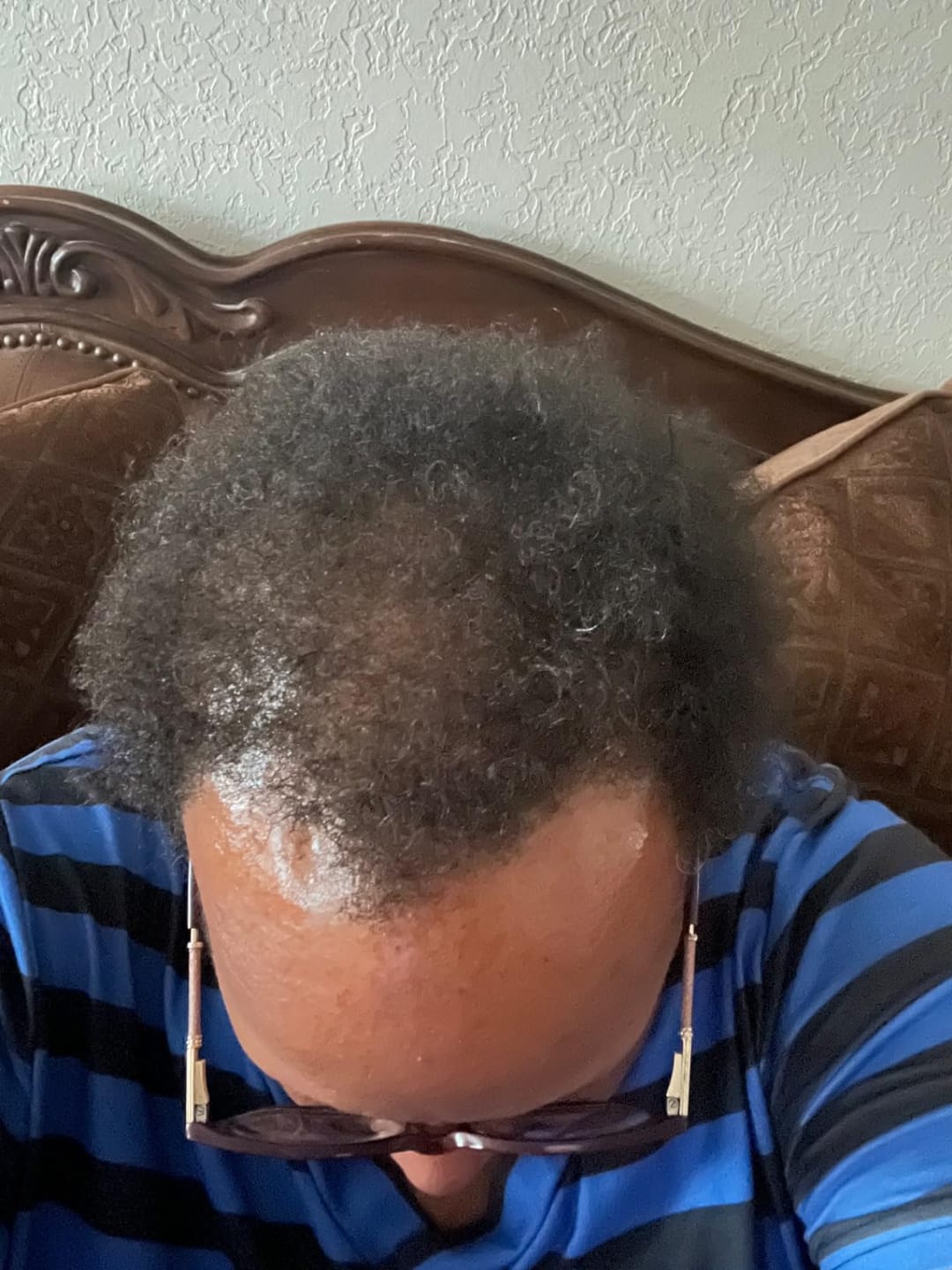 Customer photo review of NOEVA 100% Pur Batana - Le secret ancestral de cheveux sublimes