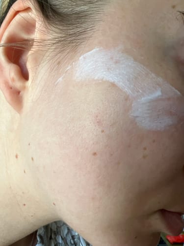 Customer photo review of Shielding Sunscreen - Tamarind & Zinc Oxide