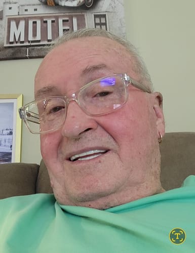 Customer photo review of Pop On Veneers with Impression Kit