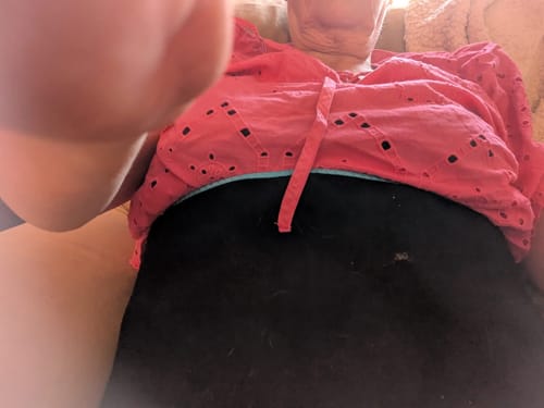 Customer photo review of DermaLux Pro