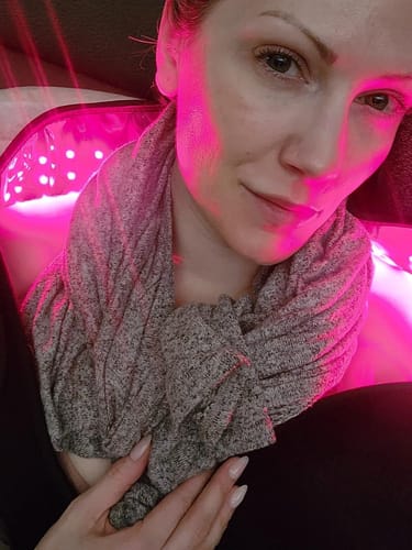 Customer photo review of DermaLux Pro