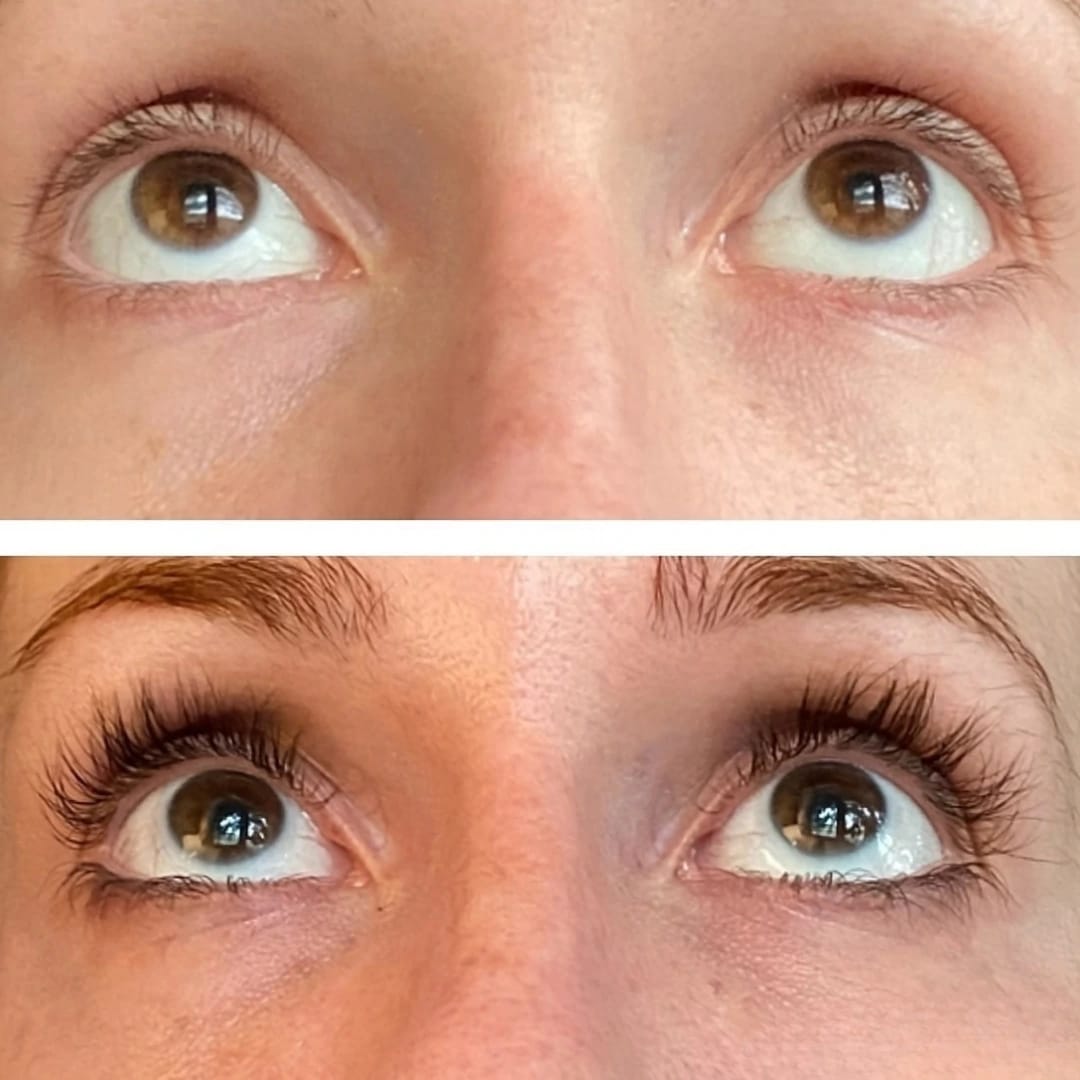 Customer photo review of LV CHAMPS EYELASH SERUM