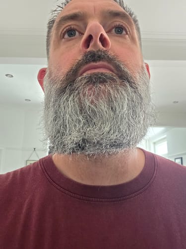 Customer photo review of Seb Natural Calming Serum