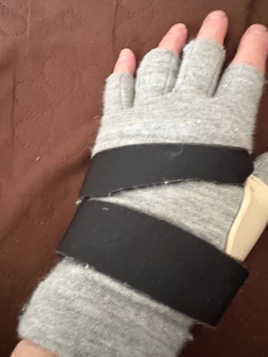 Customer photo review of Premium Onecompress™ Gloves