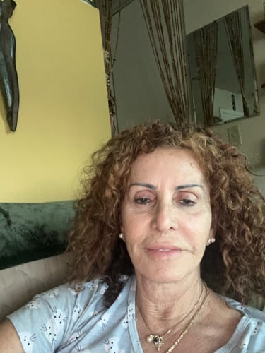 Customer photo review of Deep Collagen Cream