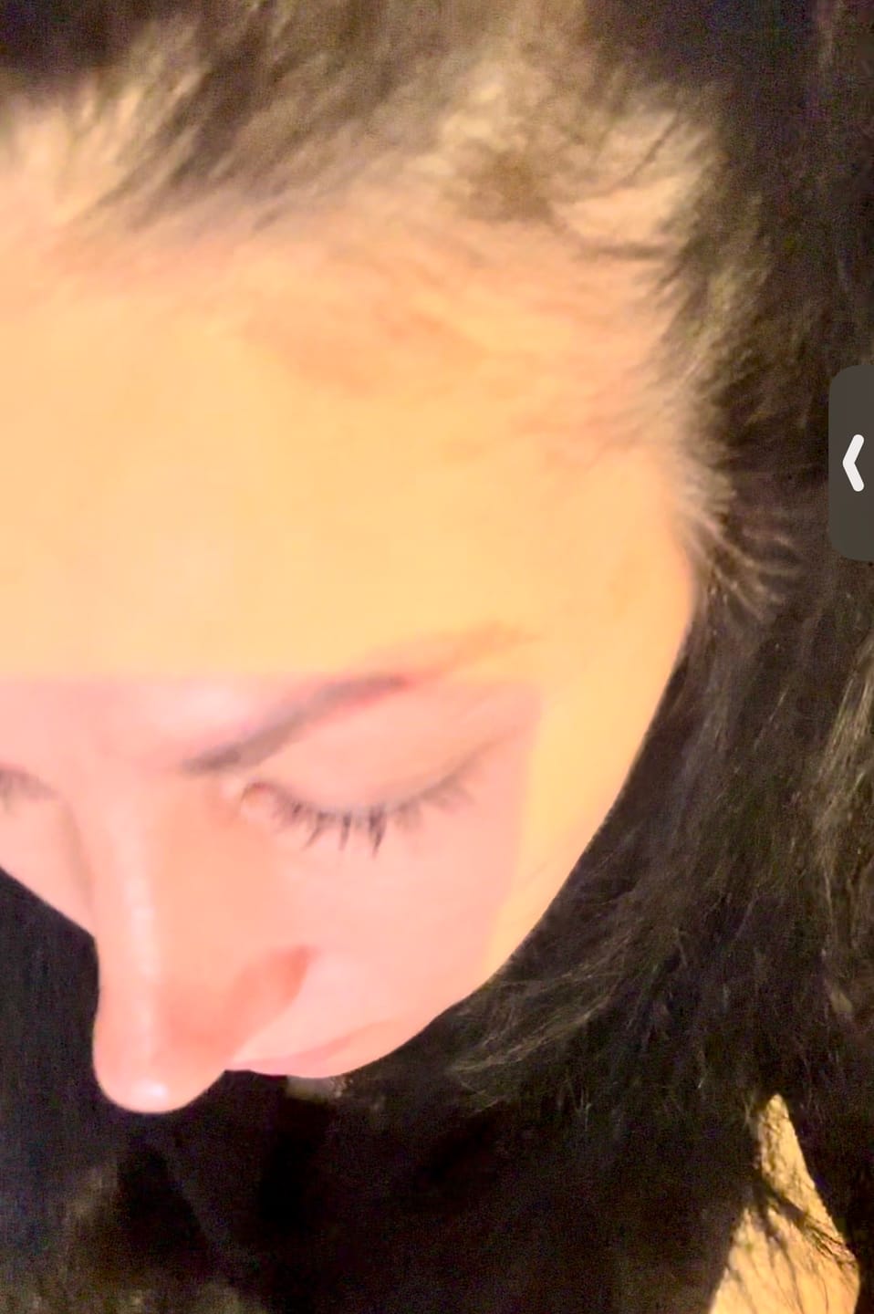 Customer photo review of Complex10™ Hair Growth Supplement