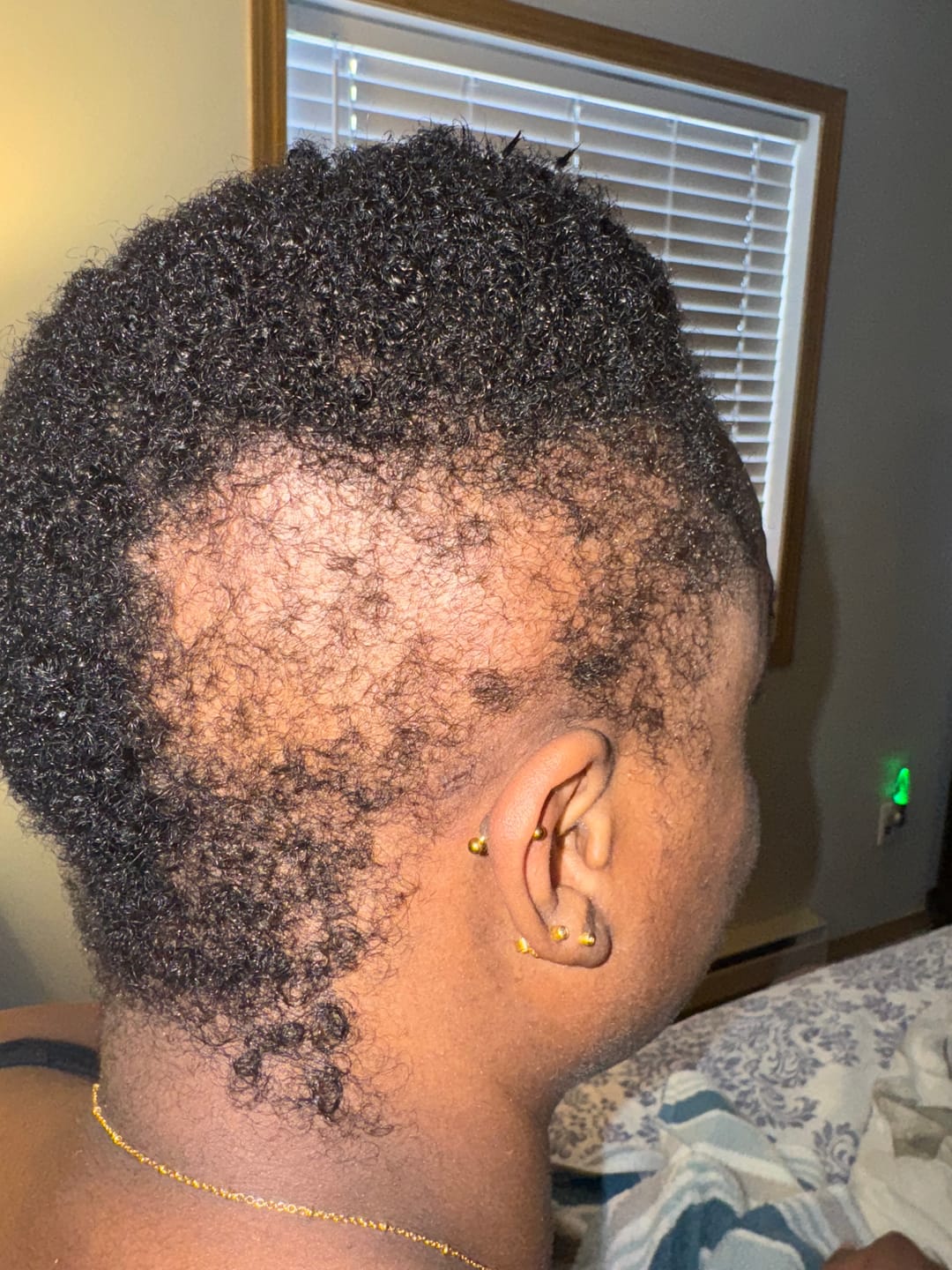 Customer photo review of Growth Stimulation Collection