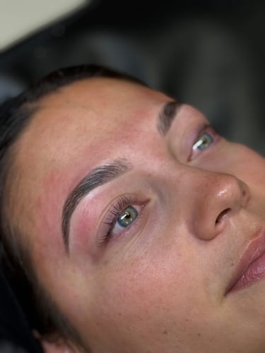 Customer photo review of TGA vs Cysteamine