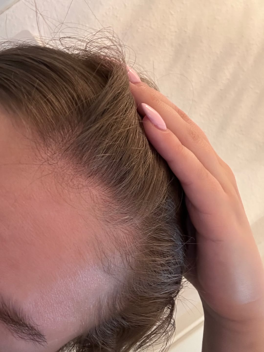 Customer photo review of HAIR GROWTH DUO