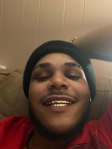 Customer photo review of Gold Grillz 8 Tooth Set