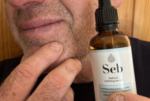 Customer photo review of Seb Natural Calming Serum