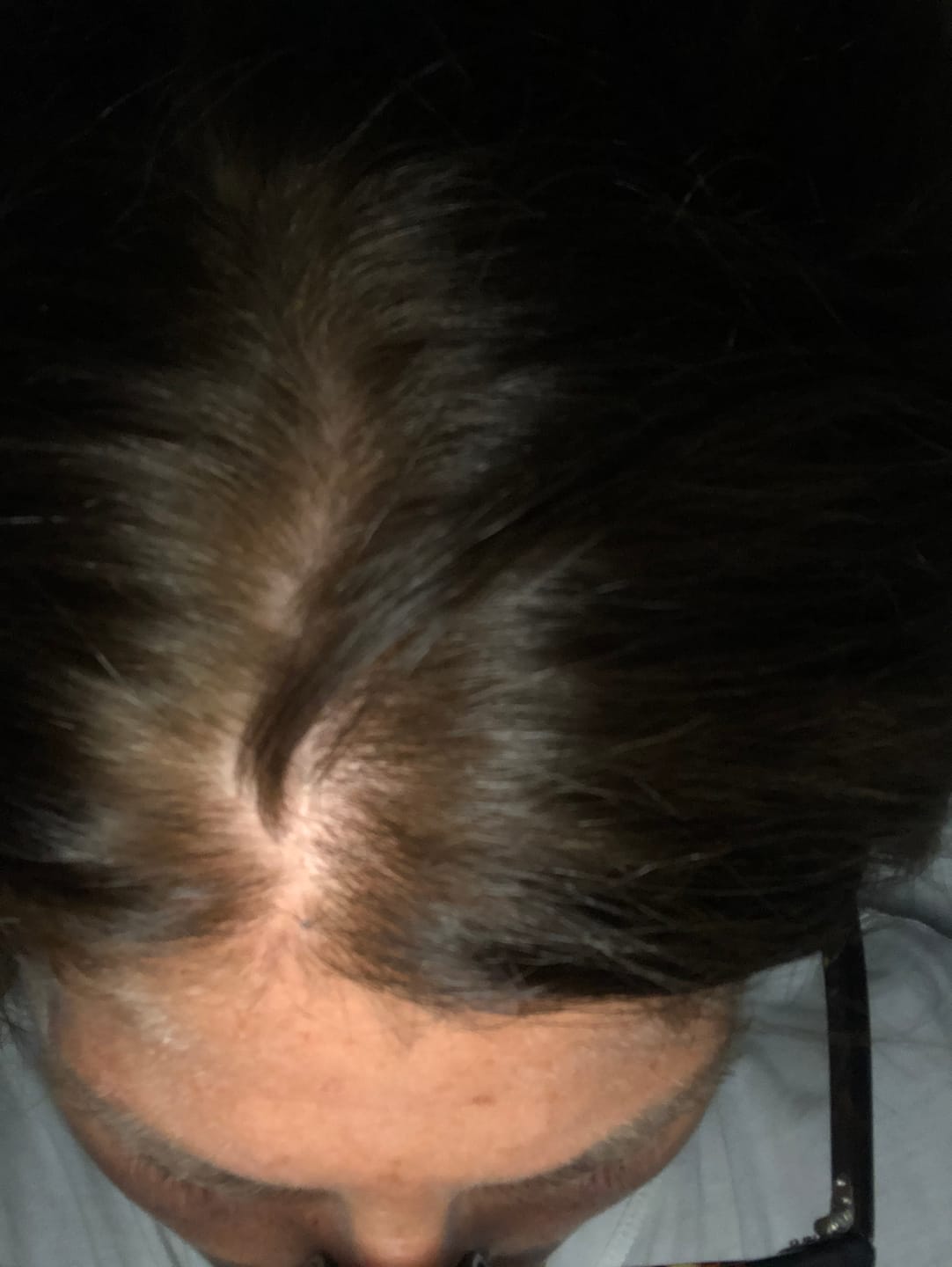 Customer photo review of BIONDO 7N + LAPPONIA