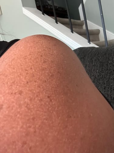 Customer photo review of S-Balm - Tallow and Zinc Sun Lotion - 2 oz.