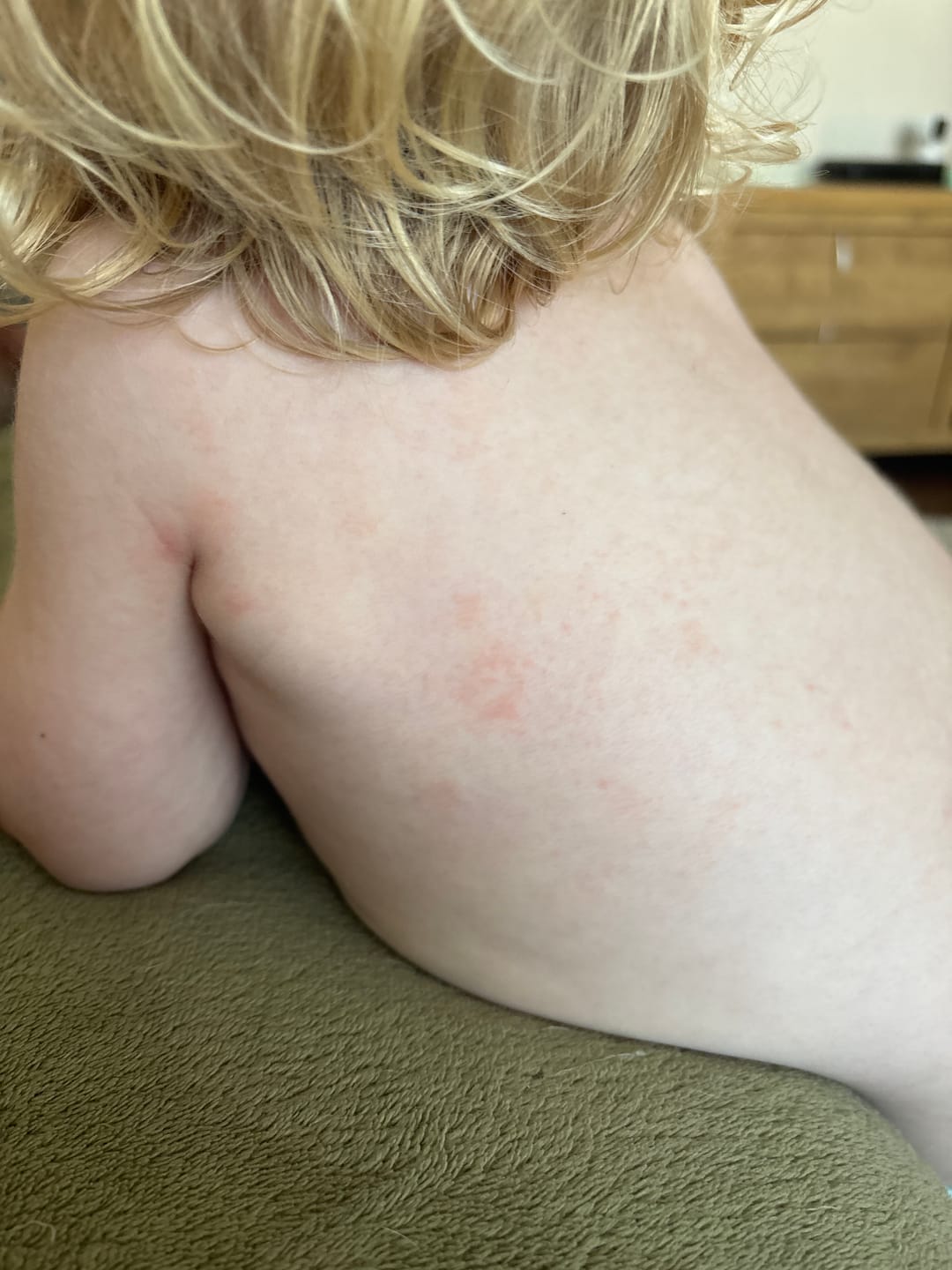 Customer photo review of Large Bioskin Junior Duo Pack