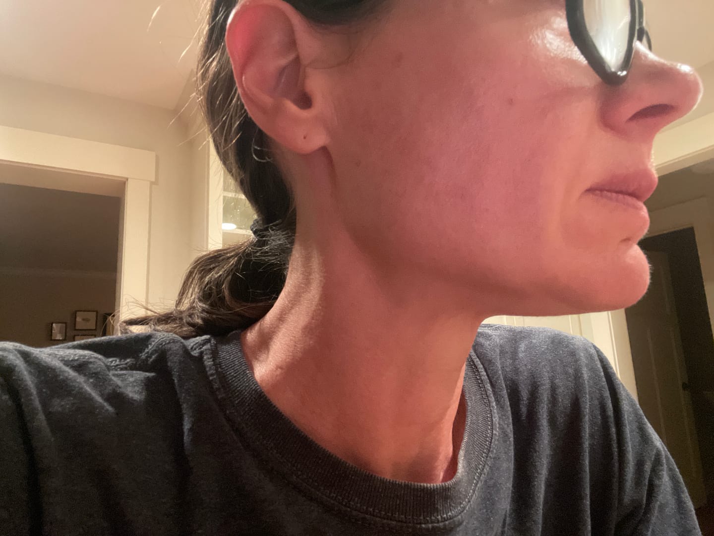 Customer photo review of Rich Rescue Phyto Mucin Cream
