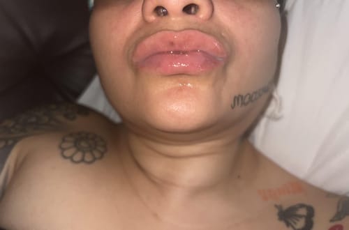 Customer photo review of Plump & Go Pen