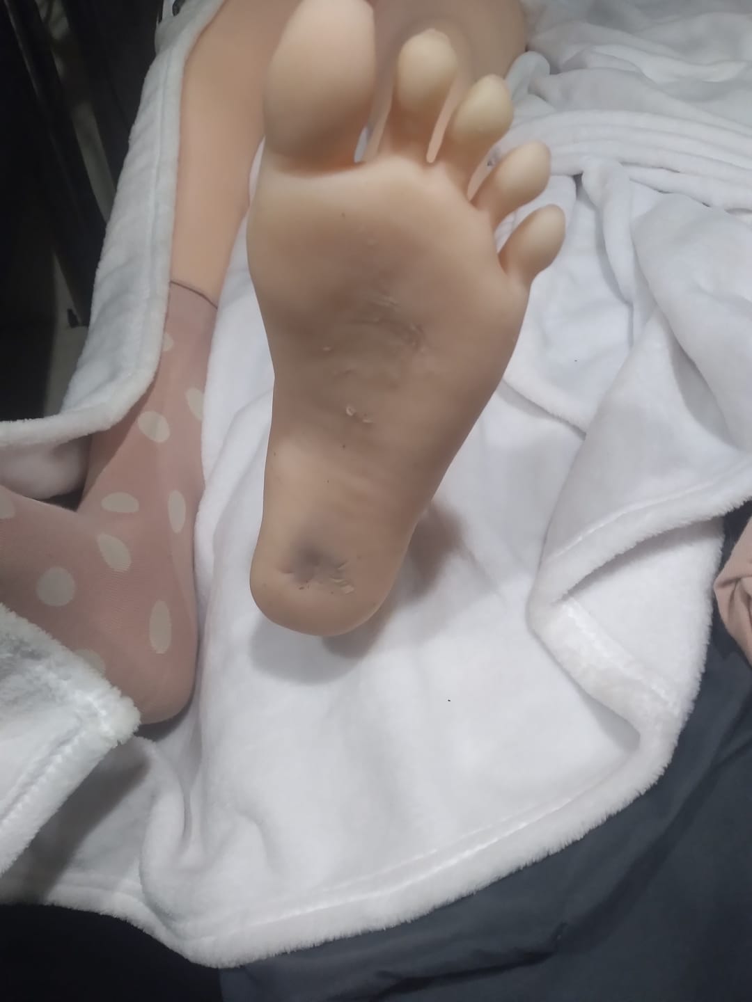 Customer photo review of Option-Standing Feet