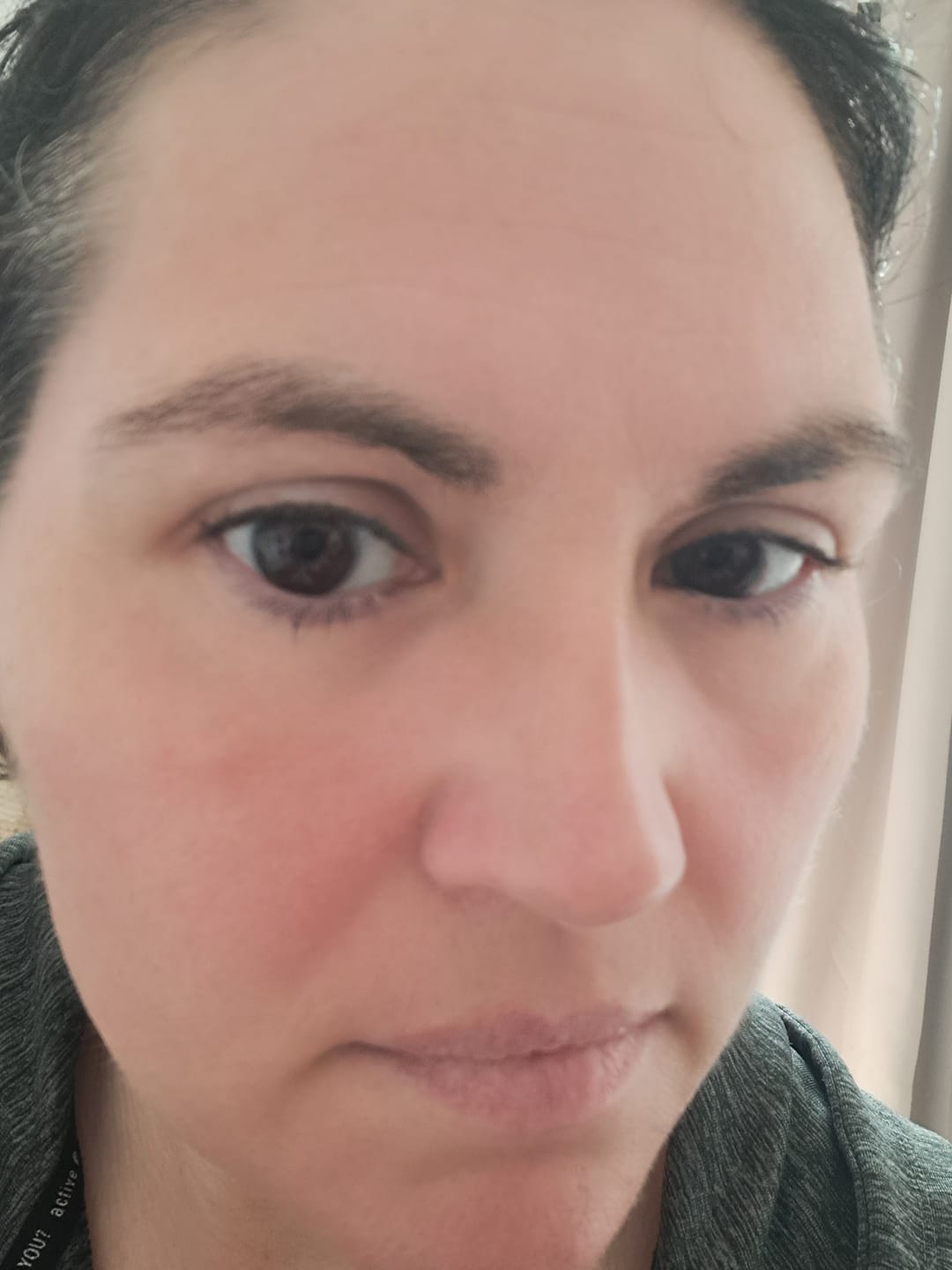Customer photo review of Eyeling Custom Lens – 1 Month