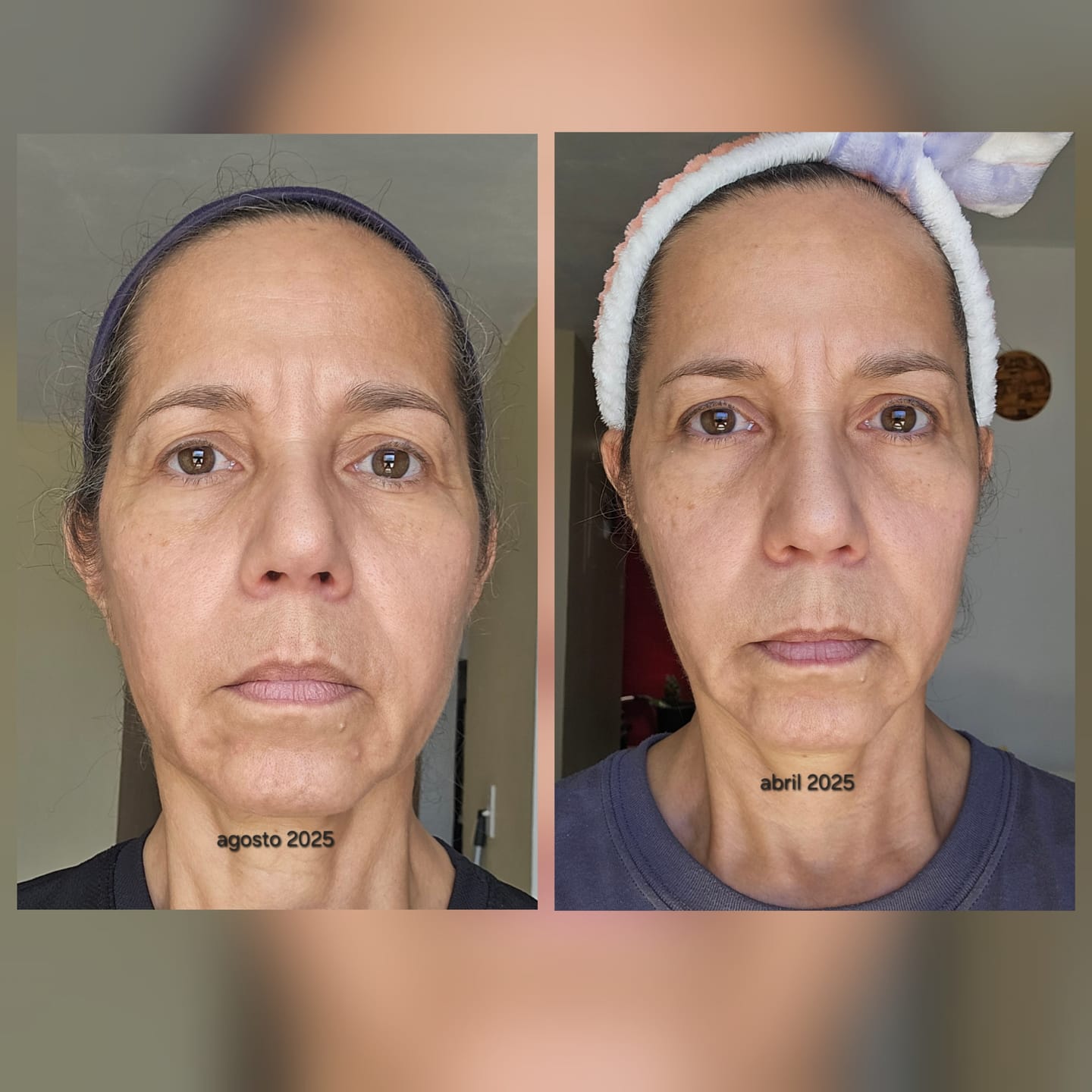 Customer photo review of Turmeric Face & Body Bundle of 3 soaps