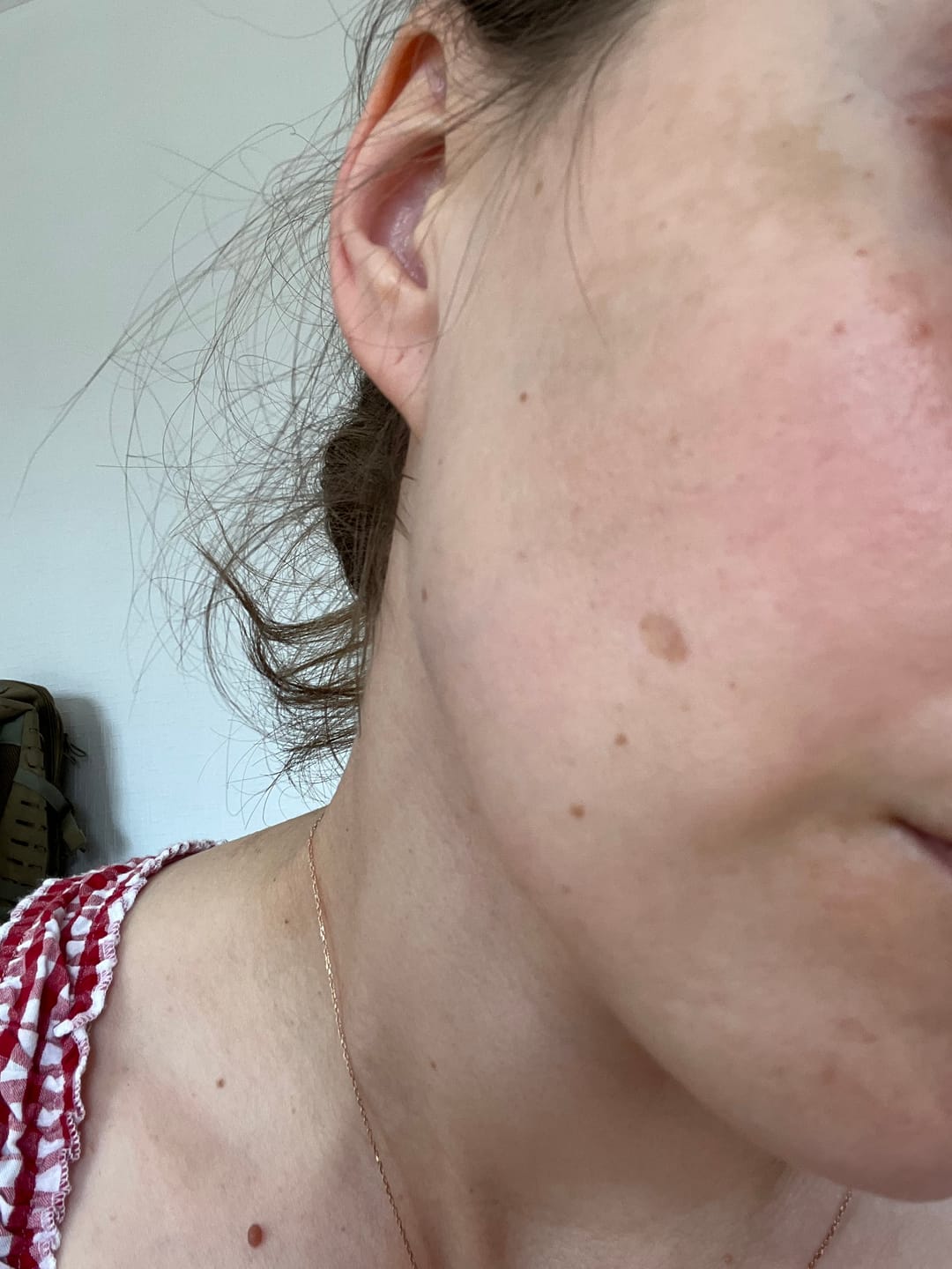 Customer photo review of Pretpigmentācijas spilventiņi Celimax Pore+Dark Spot Brightening Pad