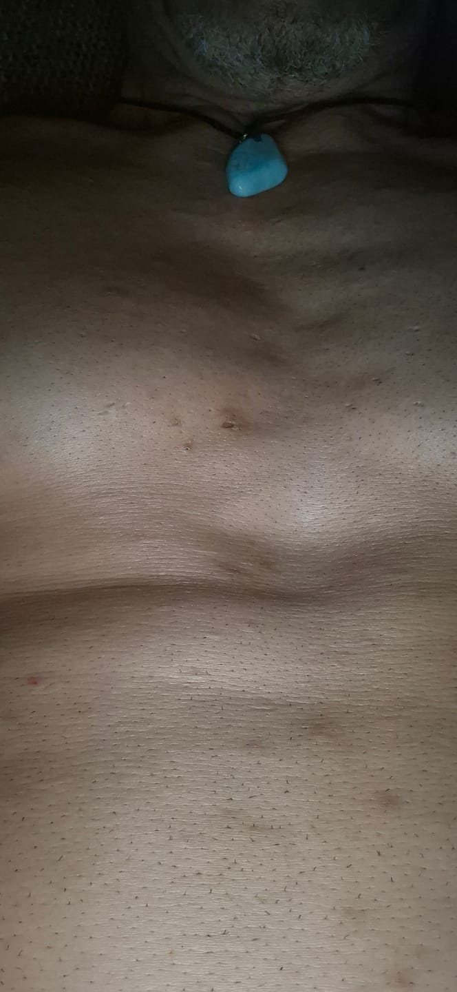 Customer photo review of 5x Belle Body Haarentfernung inkl. Gratis Enthaarungscreme