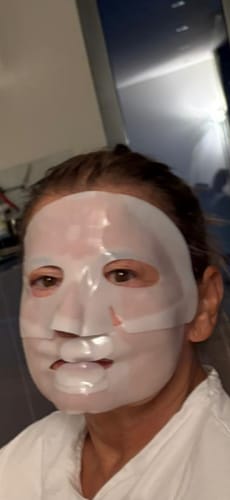 Customer photo review of Bio-Kollagen Gesichtsmaske