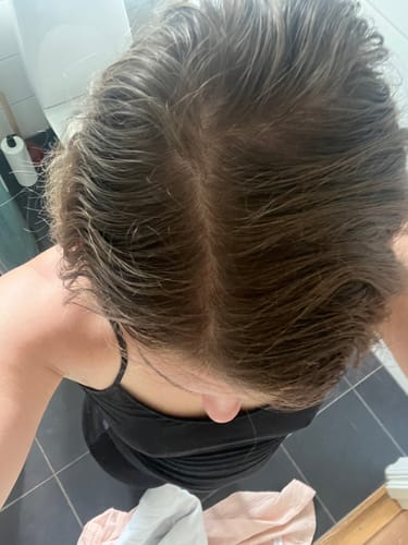 Customer photo review of Sunkissed Starter Kit