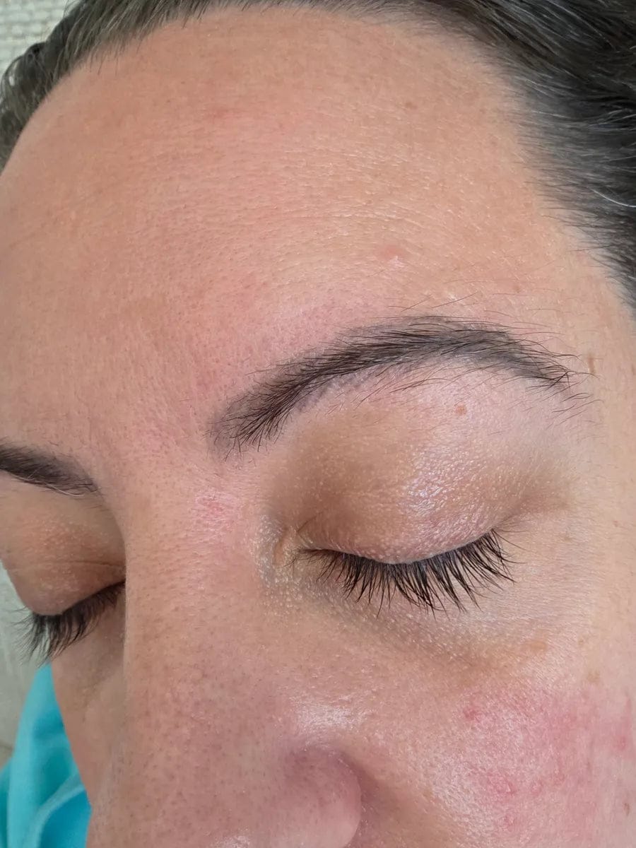 Customer photo review of Wimpernserum
