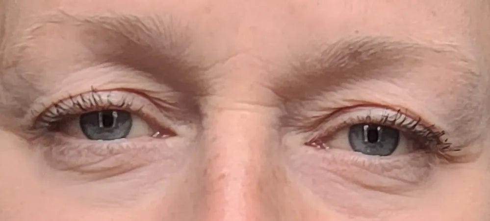 Customer photo review of Wimpernserum