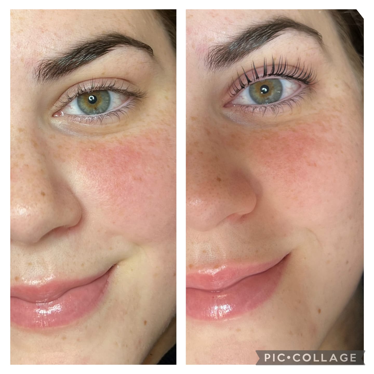 Customer photo review of Hypoallergenic Reusable Eye Pads