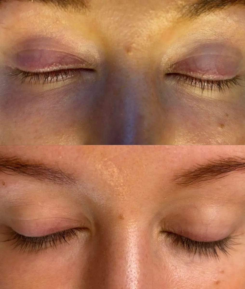 Customer photo review of Wimpernserum