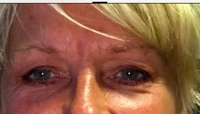 Customer photo review of Wimpernserum