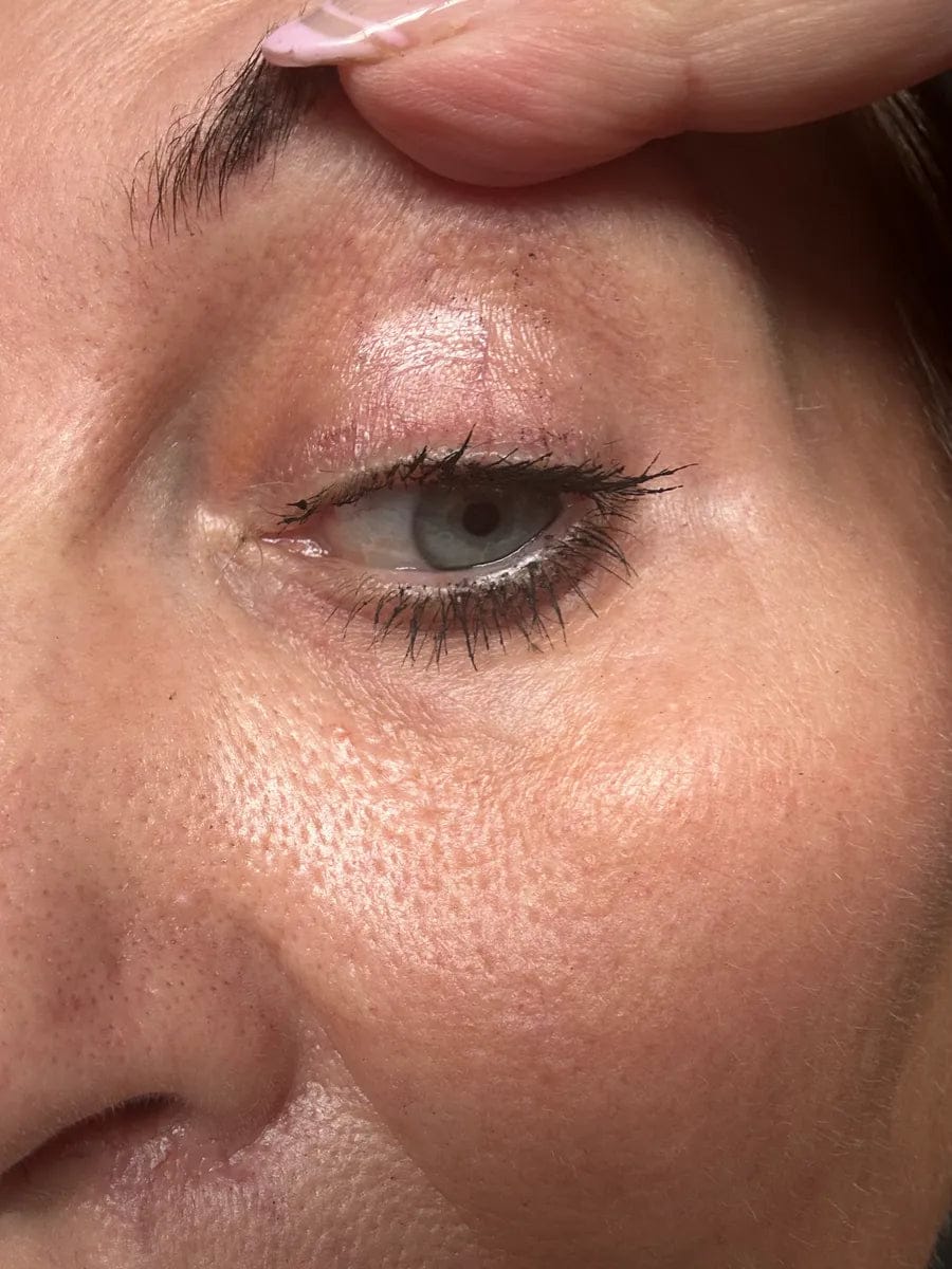 Customer photo review of Wimpernserum