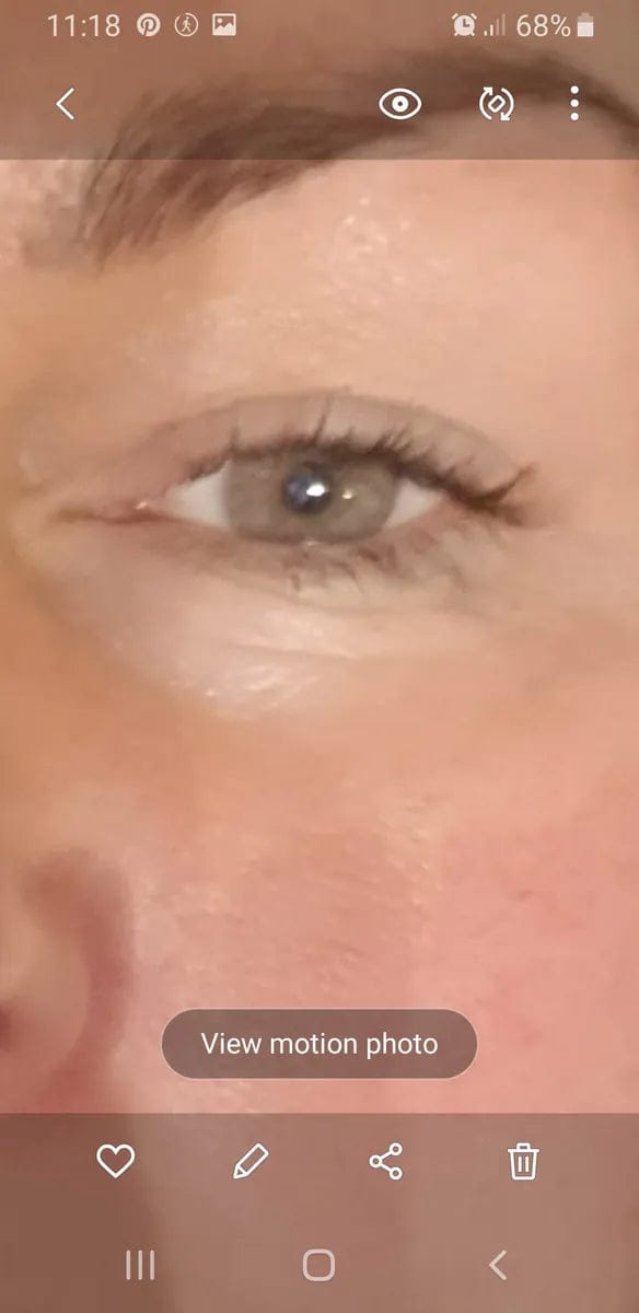 Customer photo review of Wimpernserum