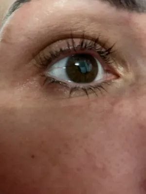 Customer photo review of Wimpernserum
