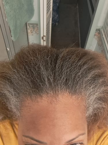 Customer photo review of Order Shipping Protection & Insurance