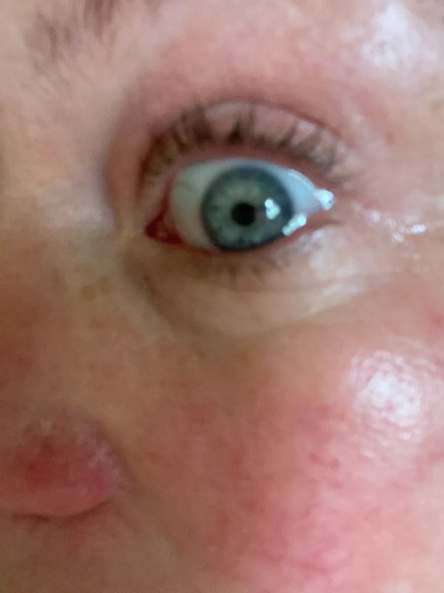 Customer photo review of Wimpernserum