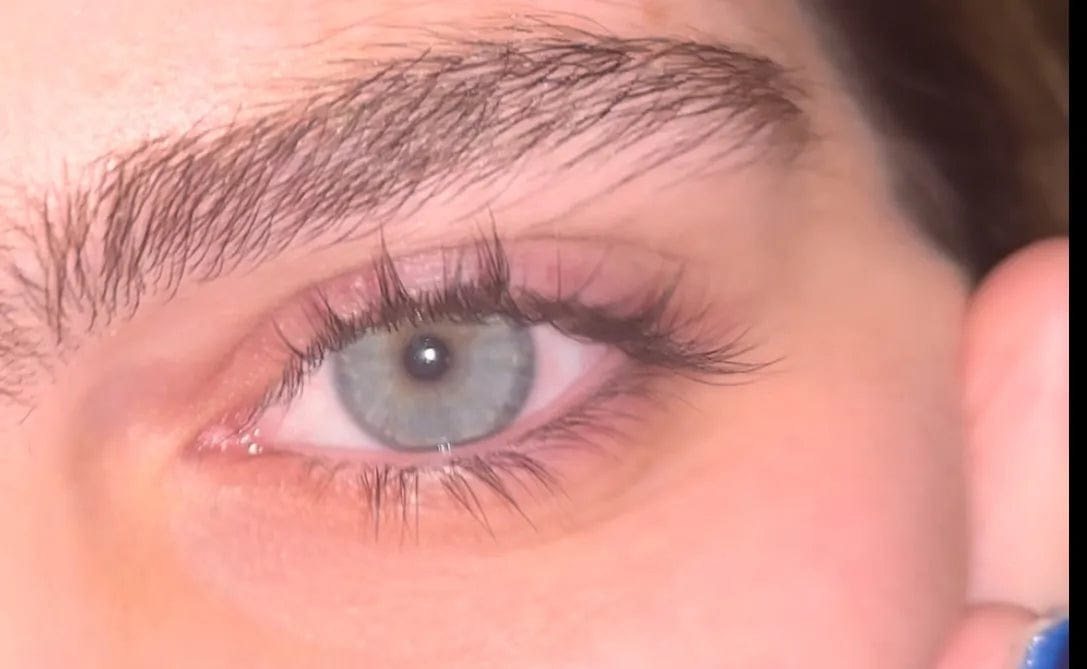 Customer photo review of Wimpernserum