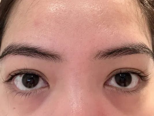 Customer photo review of Wimpernserum