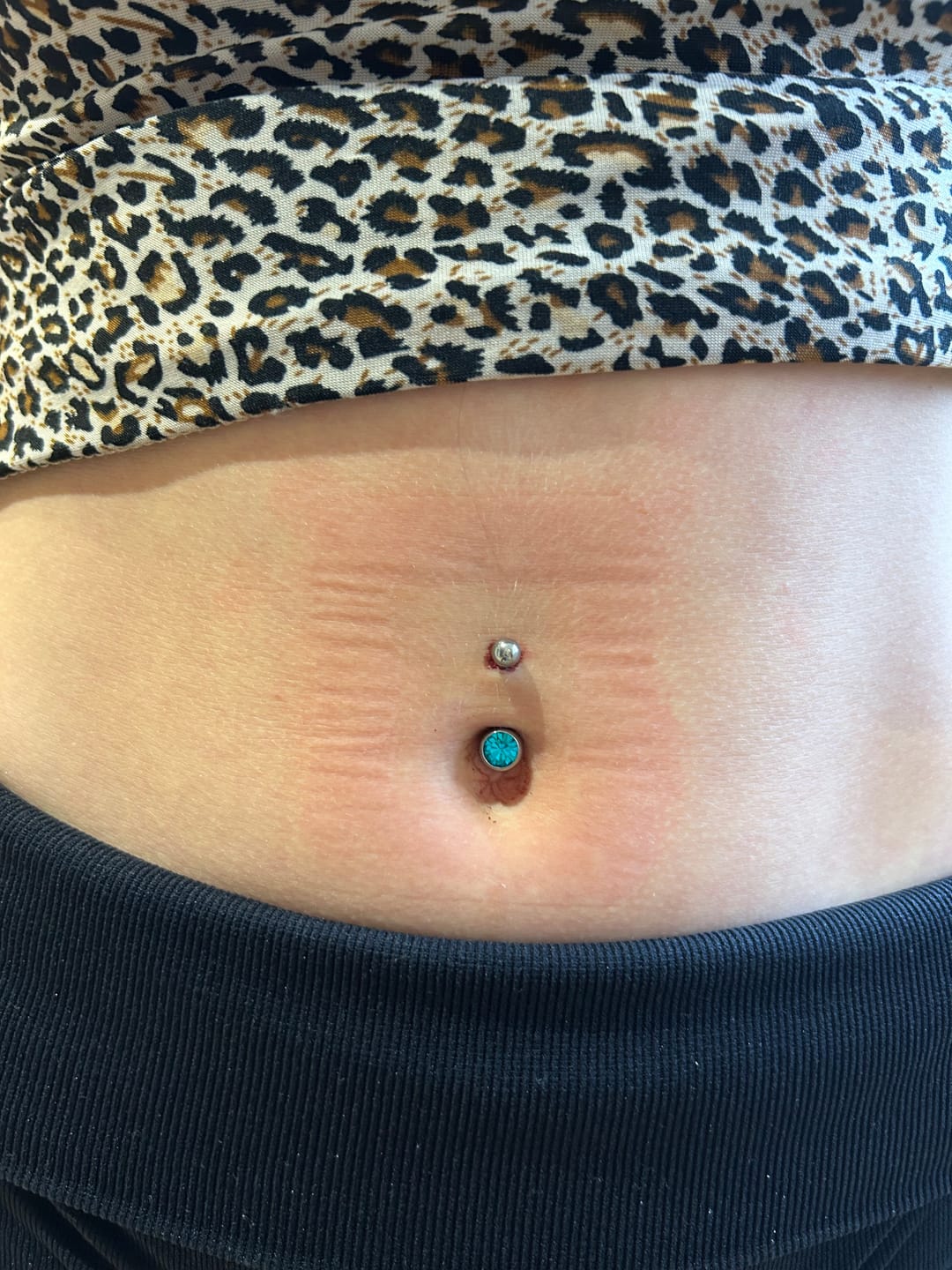Customer photo review of Piercing Aftercare Spray - Soothes & Cleanses All Piercing Types - 4oz