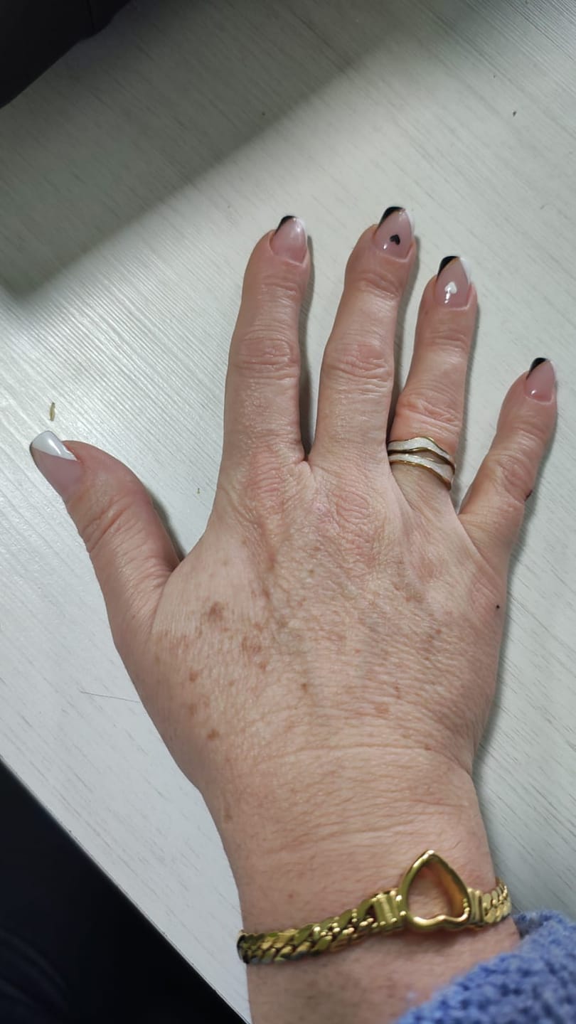 Customer photo review of Anel Abstrato Madrepérola Ajustável Banho em Ouro 18k
