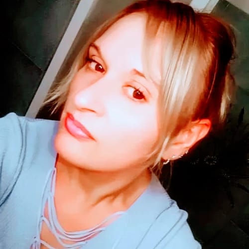 Customer photo review of Crema Contorno Occhi 3in1 (BORSE, RUGHE, OCCHIAIE)