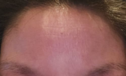 Customer photo review of B-Restore Barrier Cream + Free 20g Travel Size