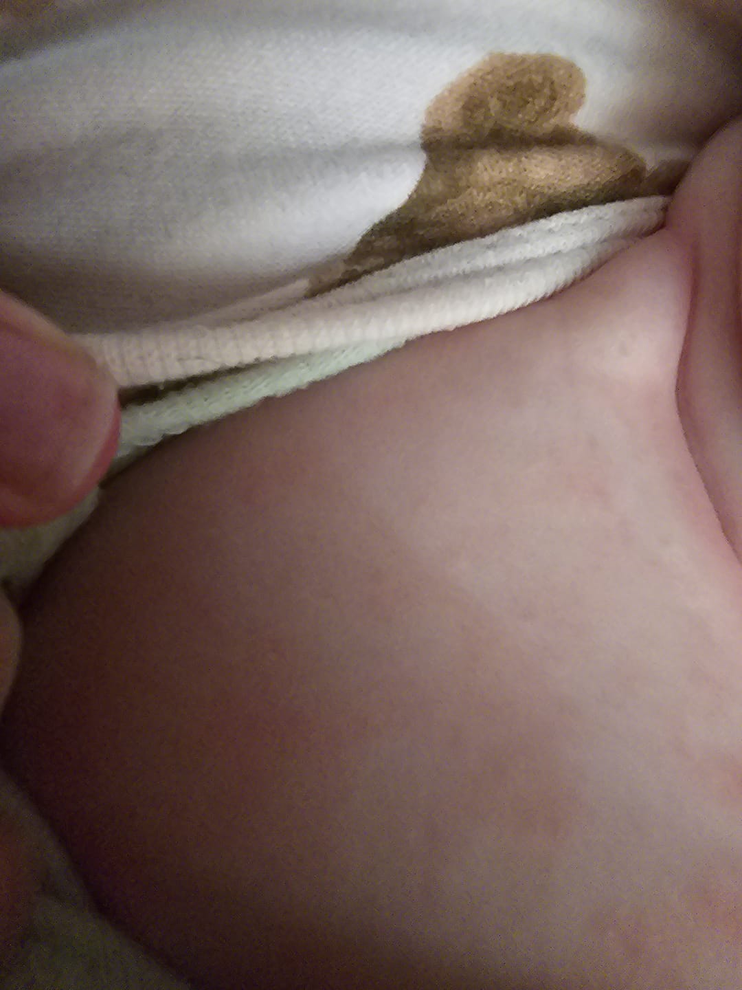 Customer photo review of Eczema Care Bundle