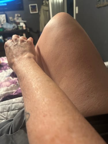 Customer photo review of Besque™ Magic Body Oil - 100ml